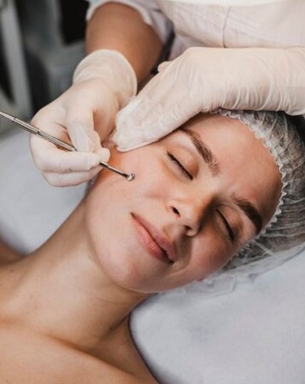 Dermaplaning